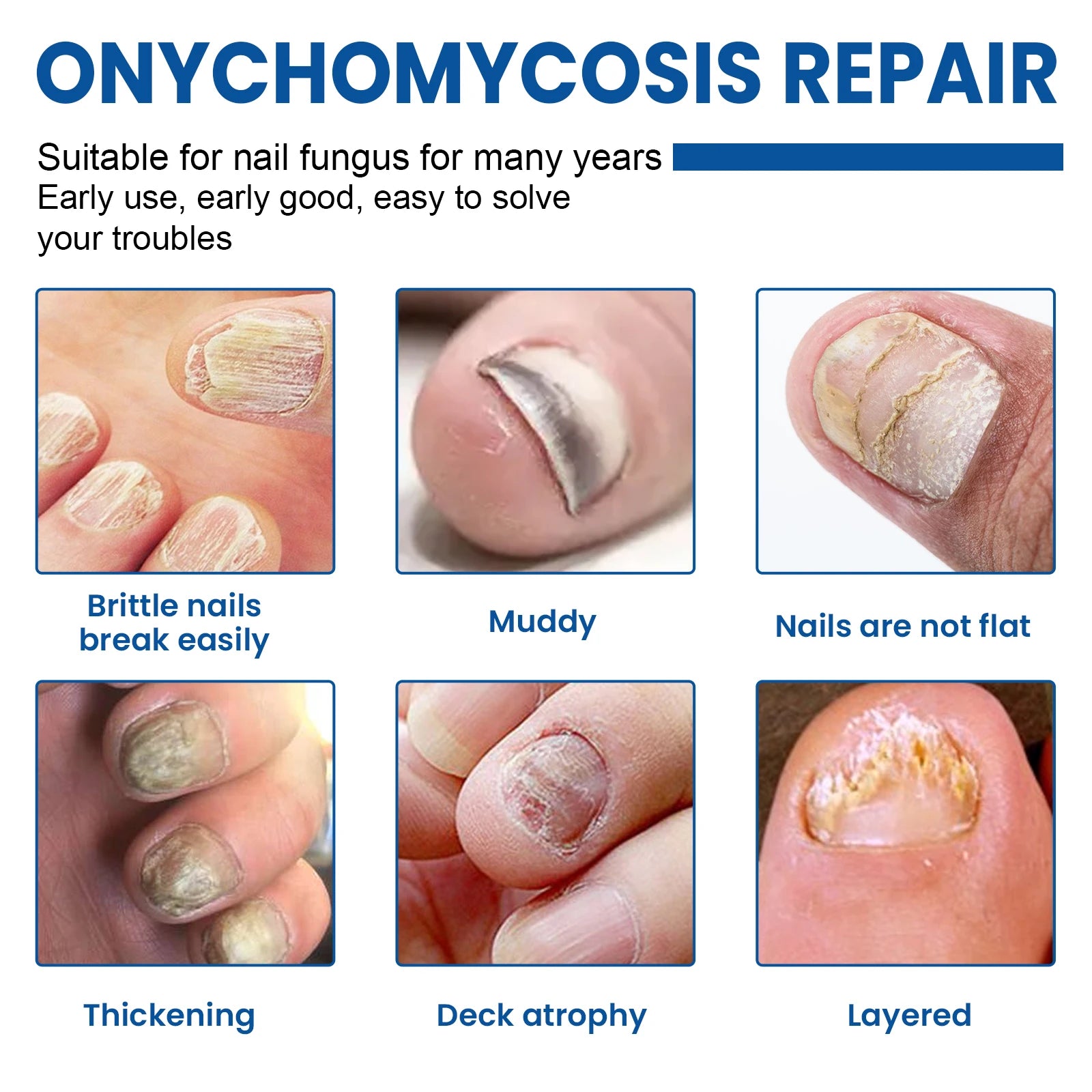 Nail repair patches for toenail fungus and ingrown nails(60 pieces)