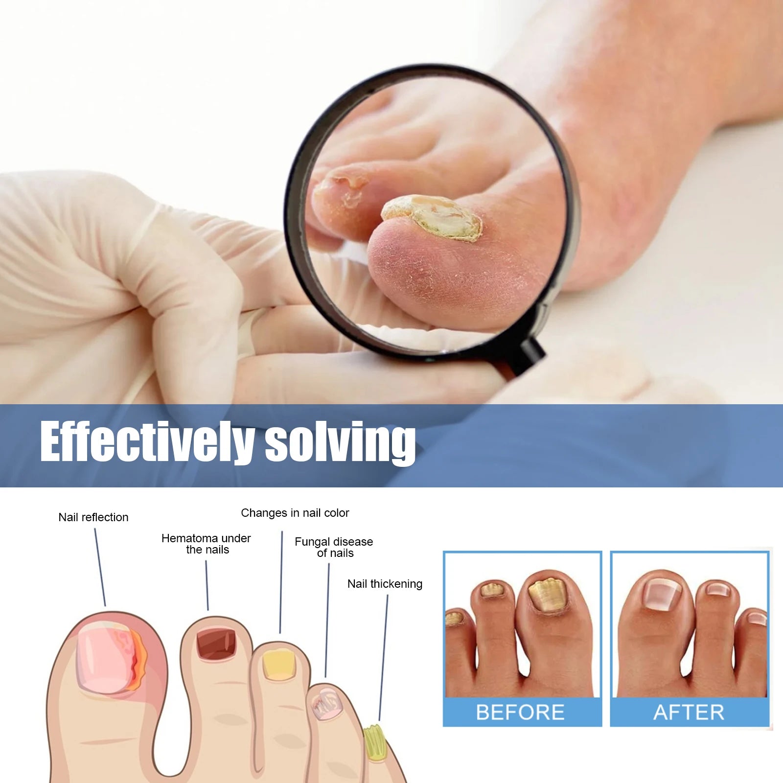 Nail repair patches for toenail fungus and ingrown nails(60 pieces)