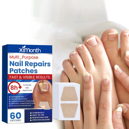 Nail repair patches for toenail fungus and ingrown nails(60 pieces)